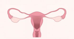 Uurka ilma qoolan, Ectopic Pregnancy