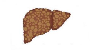 Beer qolfoofid, beer xanjoobid, beerka,